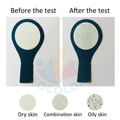 Handy Dandruff Test Card